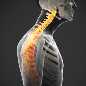 Unlocking Upper Crossed Syndrome: A Massage Therapist’s Guide