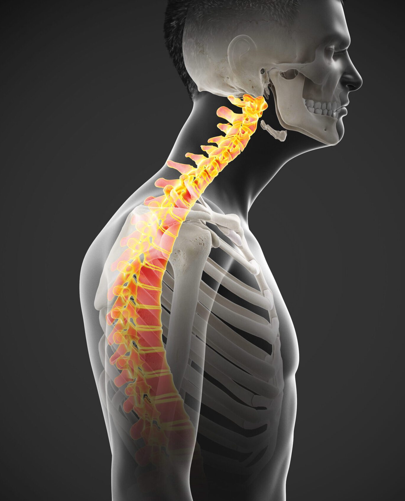 Unlocking Upper Crossed Syndrome: A Massage Therapist’s Guide
